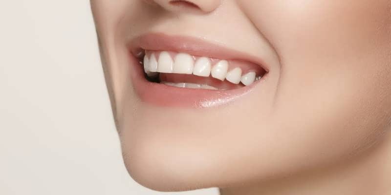 Dental Crowns & Bridges