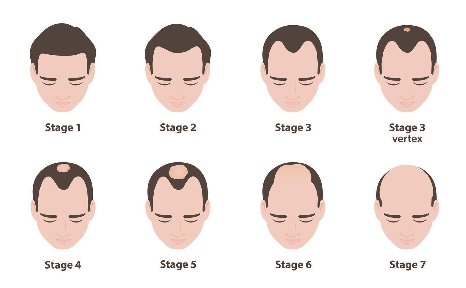 PRP, GFC & Hair Transplant